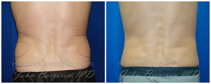 Love Handles