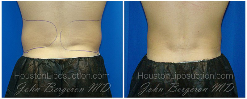 Love Handles