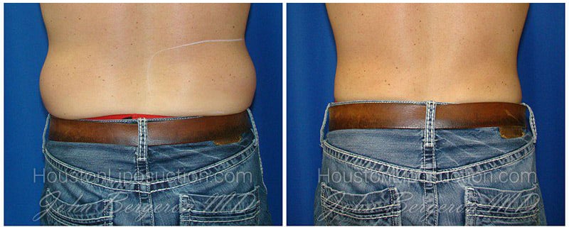 Love Handles