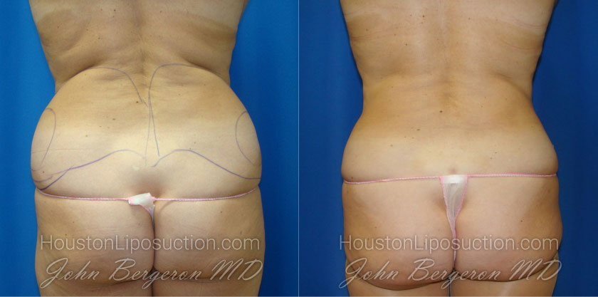 Waist & Hip