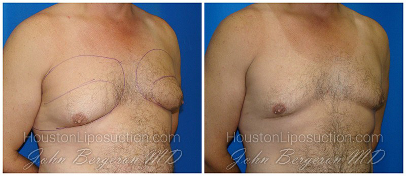 Male Chest