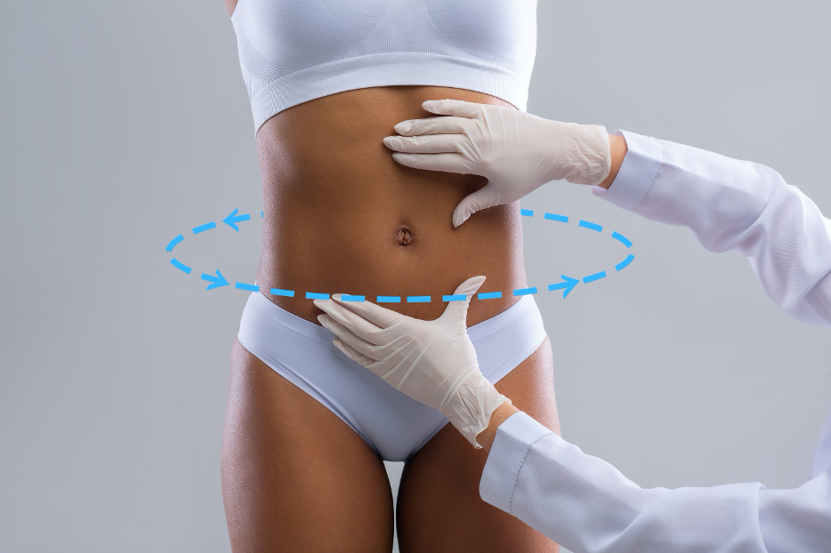 What is Lipo 360°? - Houston Lipo Center