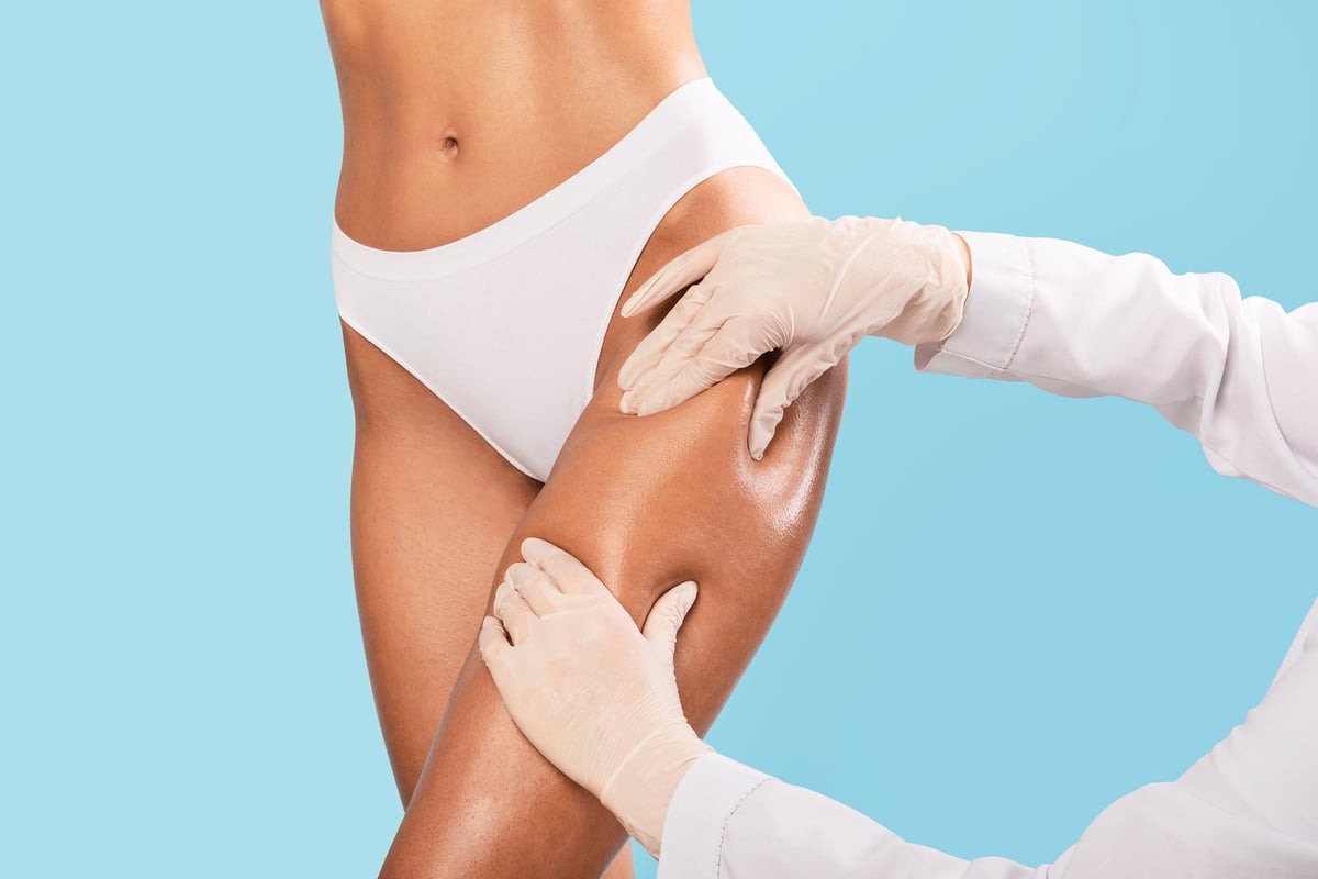 Waist & Hip Liposuction / Houston Lipo Center