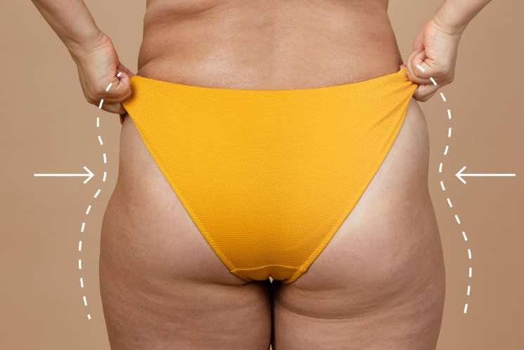 HipDips Is Helping Women Realize Their Bodies are 'Normal